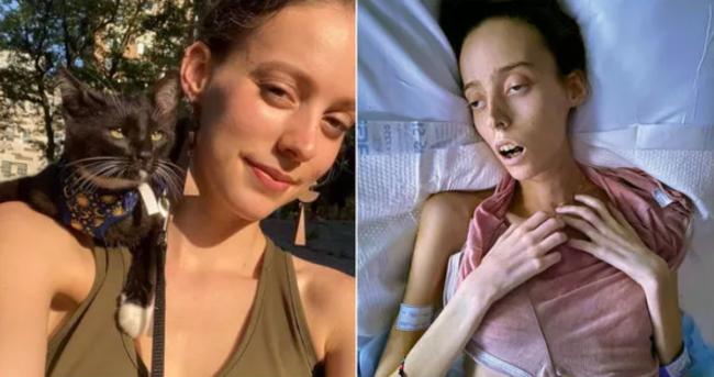 24岁女只是喉咙痛 竟惨到患皮肤癌，7个月后走了