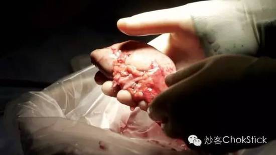 10 大死亡猛药逐个数: 就在我们身边，只是你不知道