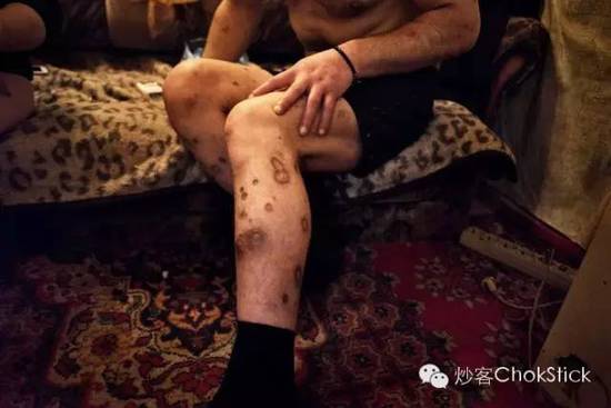 10 大死亡猛药逐个数: 就在我们身边，只是你不知道