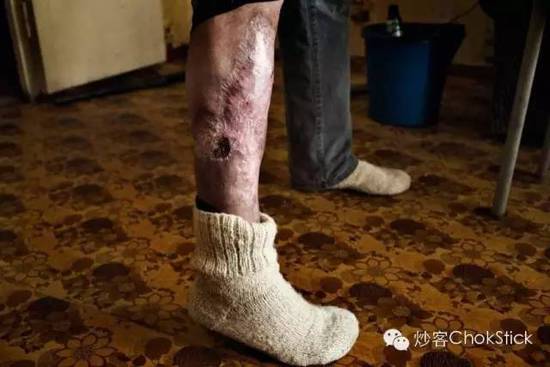 10 大死亡猛药逐个数: 就在我们身边，只是你不知道