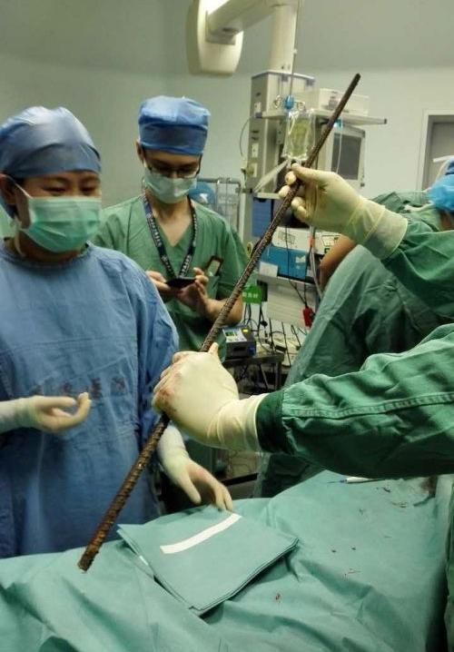 被钢筋穿体,他们用7小时完成这台无法想象的手术