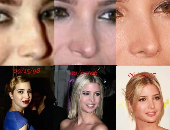Ivanka_nose_jobs.jpg