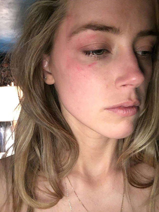 软妹：世界最顶级的美女也曾遭受毒打，颜值并不能让她们远离家暴