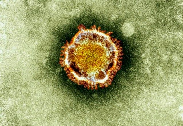 Image result for Quebec health officials monitoring 5 people for possible cases of coronavirus