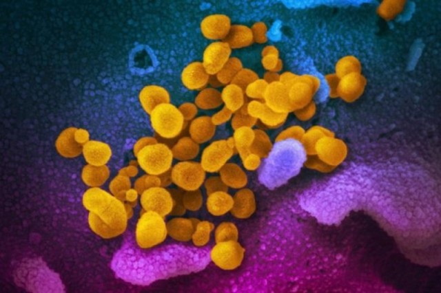 “B.C. confirms 4 new cases of COVID-19, provincial total climbs to 12”的图片搜索结果