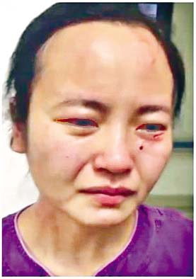 ■广州一名女护士被外籍患者咬伤。
网络图片