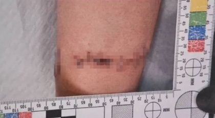 大温华人女子操刀冲进法庭 狂捅同胞 血溅满地