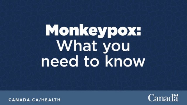 What you need to know