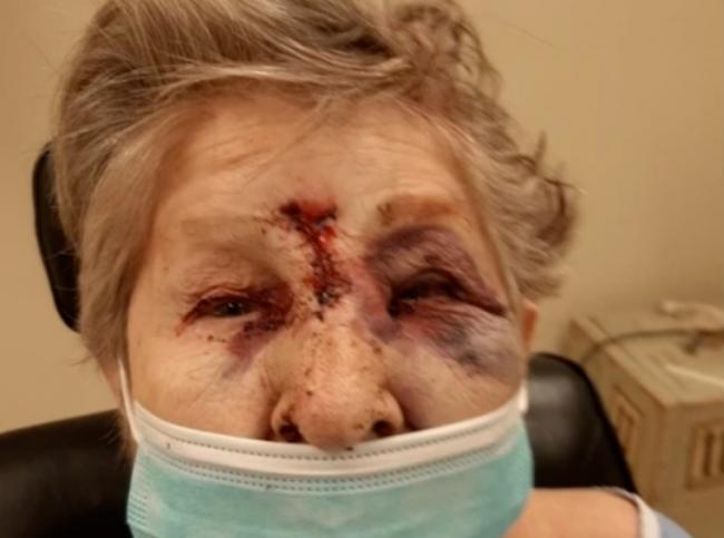 悲剧:等不到救护车,大温男子倒在血泊中身亡 悲剧:等不到救护车,大温男子倒在血泊中身亡