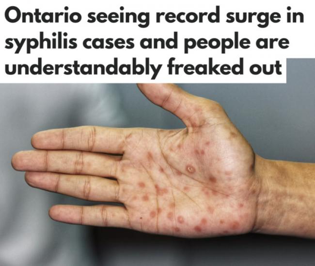 加拿大这里梅毒疫情爆发 孩子最容易被传染