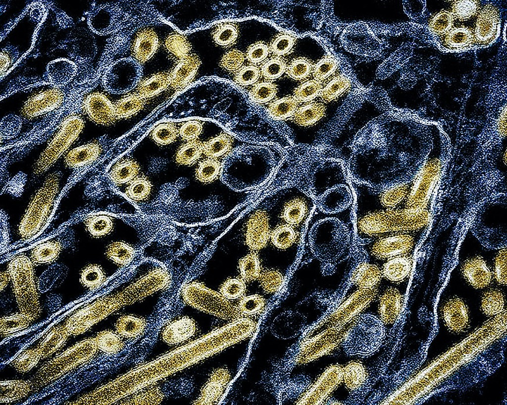 甲型H5N1禽流感病毒颗粒(金色)。 甲型H5N1禽流感病毒颗粒(金色)。