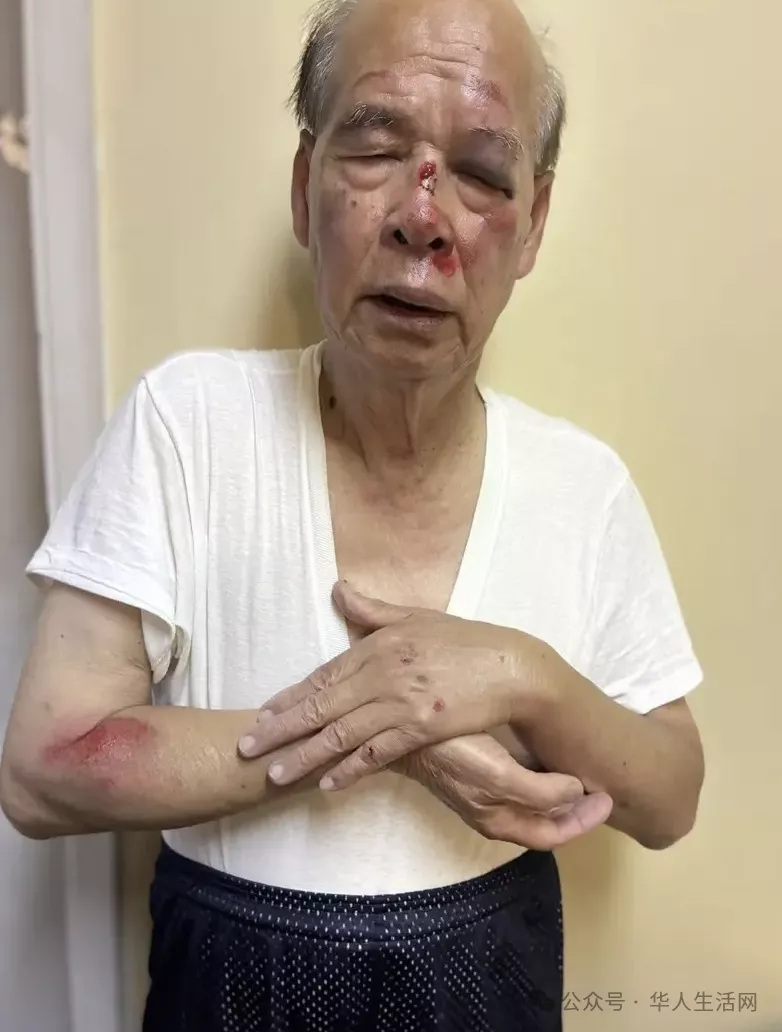 93岁知名侨领被女贼抢劫拖行！南加治安再亮红灯